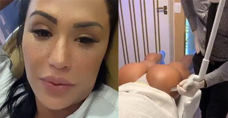 Gracyanne Barbosa anestesia o bumbum para ficar com glúteos lisinhos