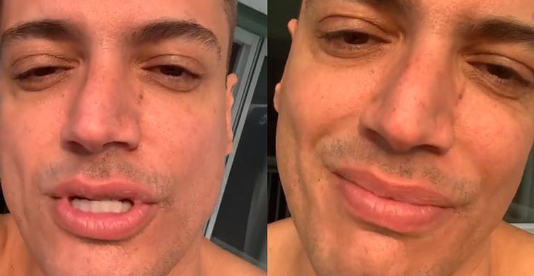 Leo Dias sai em defesa de Pedro Scooby: ”Tem direito de fazer o que quiser entre quatro paredes”