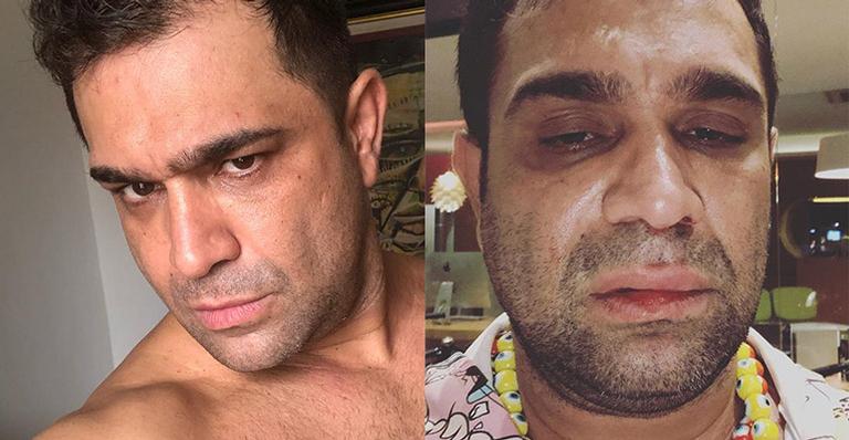 Humorista Evandro Santo é agredido após show e faz denúncia: ‘Homofobia’