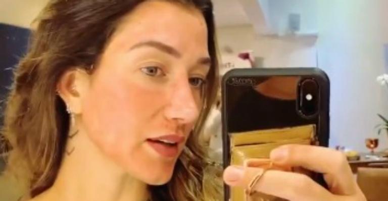 Gabriela Pugliesi surge com o rosto vermelho depois de tratamento: ”Muita diferença”