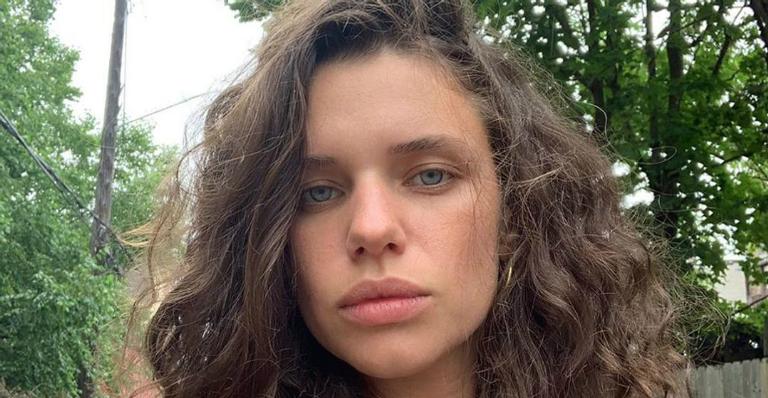 Bruna Linzmeyer passa dos limites ao tomar sol e fica com marquinha de biquíni indesejada