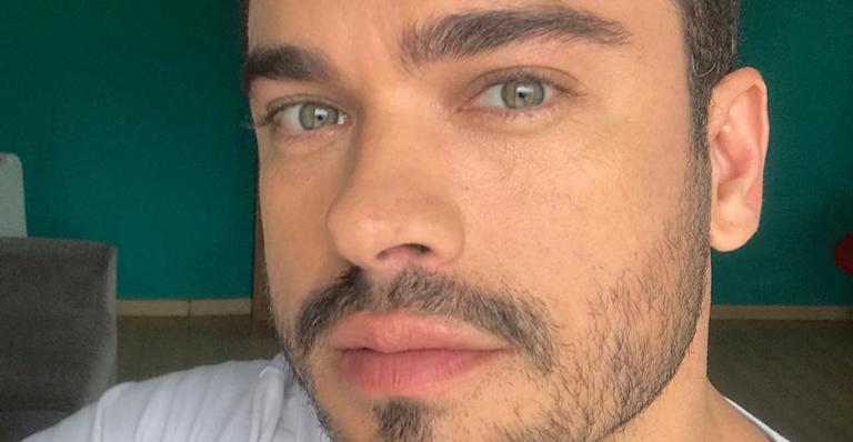 Careca, Sidney Sampaio passa por tratamento contra calvície: ”Feliz com o resultado”