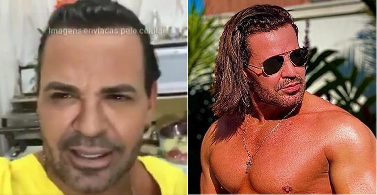 Eduardo Costa defende novo visual e explica mudança radical: ”Tem um contexto”