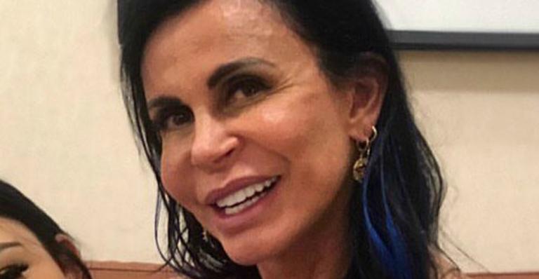 Gretchen retoca harmonização facial e resultado inacreditável impressiona: ”Estou normal”