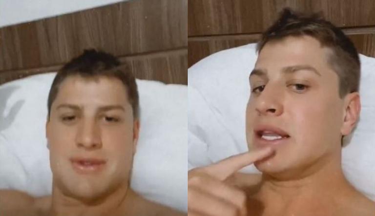 Ex-BBB Lucas Gallina passa por tratamento estético e mostra resultado