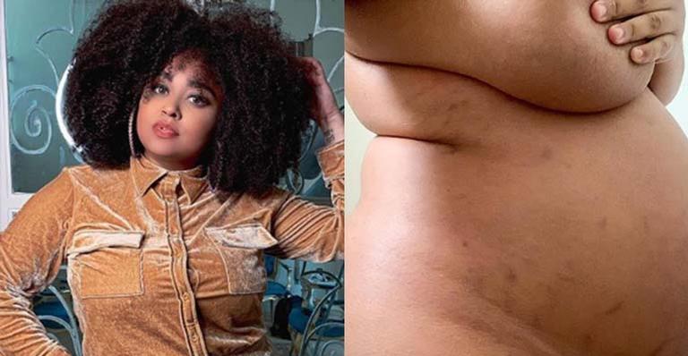 Ex-BBB Rízia Cerqueira posa nua exibindo barrigão de grávida em foto real: ”Ansiedade e medo”