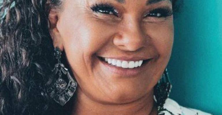 Solange Couto surge com as raízes brancas, é chamada de velha e rebate: ”É sinônimo de realização”