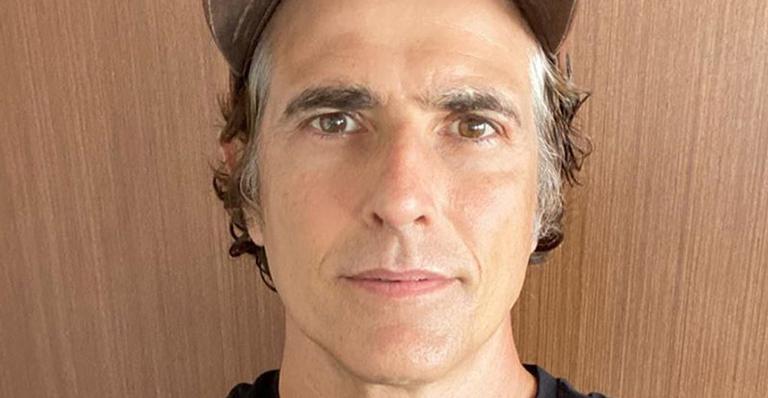 Reynaldo Gianecchi mostra o pé e fãs ficam em choque: ”Alguma coisa tinha que ser feia”
