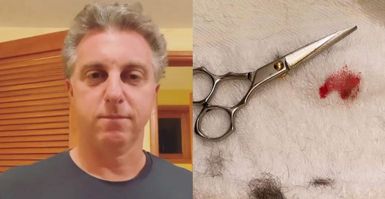 Luciano Huck surge com dedo sangrando ao relatar acidente com Angélica em casa