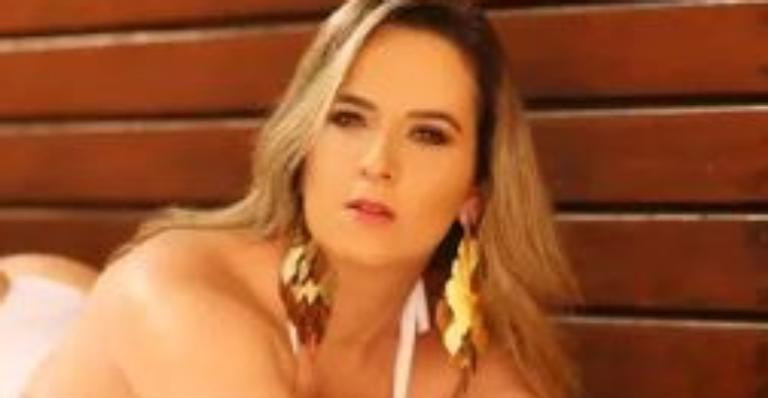 Ex-candidata ao Miss Bumbum sofre acidente gravíssimo de moto e perde um dos braços