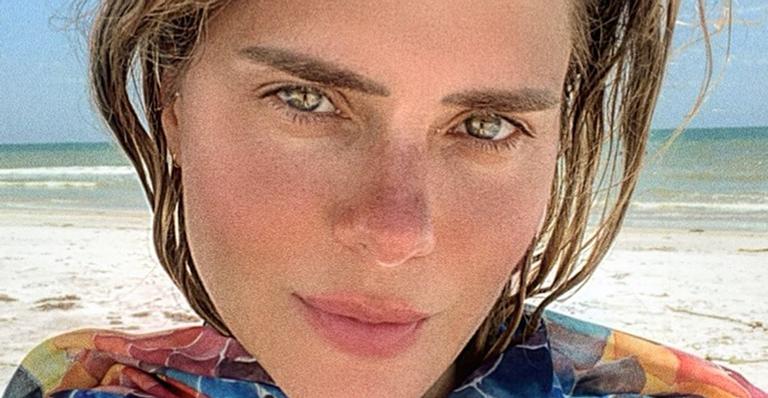 Família de Carolina Dieckmann faz vaquinha para pagar cirurgia da tia da atriz