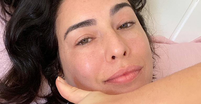 Fernanda Paes Leme tranquiliza fãs após passar por cirurgia delicada: “Foi tudo bem”