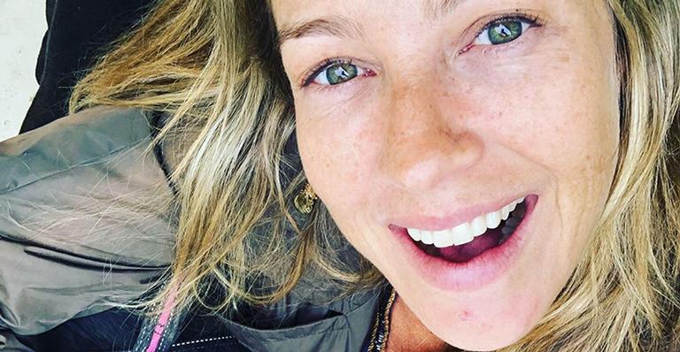 Luana Piovani surge bem diferente em foto antiga e explica motivo: “Fiz plástica dentária”