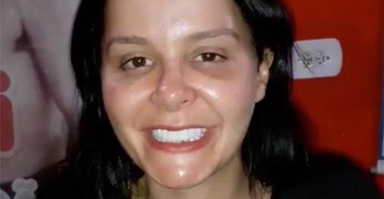 Plástica? Maraisa decide explicar vídeo em que surge com o rosto deformado