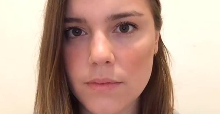 Alice Wegmann sofre acidente e passa por operação de emergência: “Caí feio”