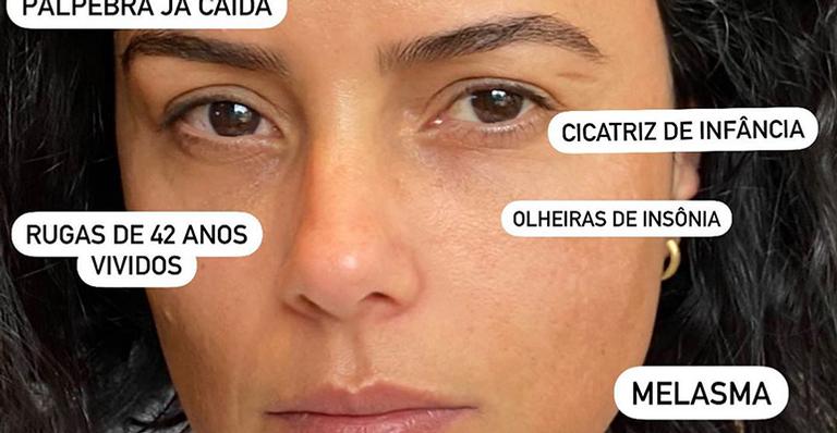 Luciele di Camargo assume imperfeições no rosto e desabafa: “Reconhecer é um desafio”
