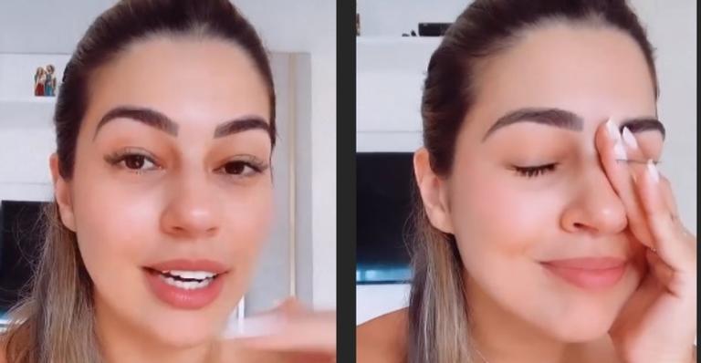Vivian Amorim sofre corte de linha de pipa com cerol: ”Fique desesperada”