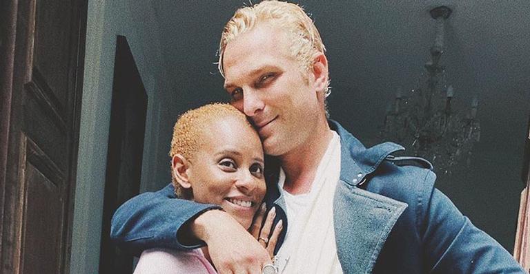 Em desabafo, Igor Rickli critica idealização do seu casamento com Aline Wirley: “Ele não é perfeito”