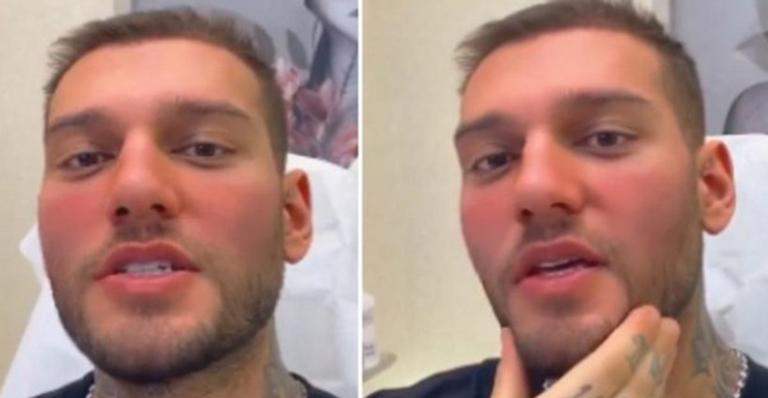 Lucas Lucco surpreende ao anunciar reversão da harmonização facial: “Ultrapassou o limite”