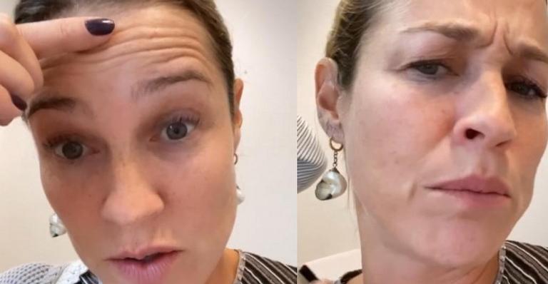 Aos 44 anos, Luana Piovani faz procedimento para eliminar marcas de expressão