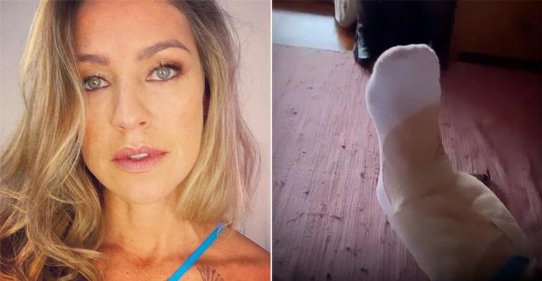Luana Piovani sofre acidente com cachorro de estimação: “Fui parar no hospital”