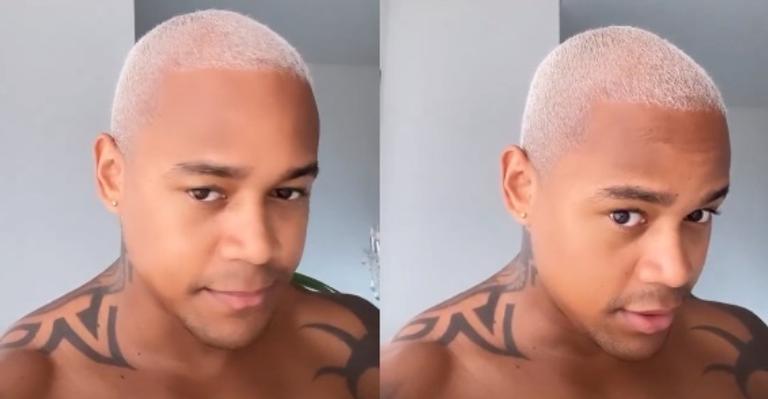Léo Santana surpreende ao mostrar antes e depois de transplante capilar