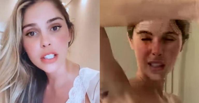 Bárbara Evans mostra hematomas no braço após cirurgia de lipoaspiração: “O roxo faz parte”