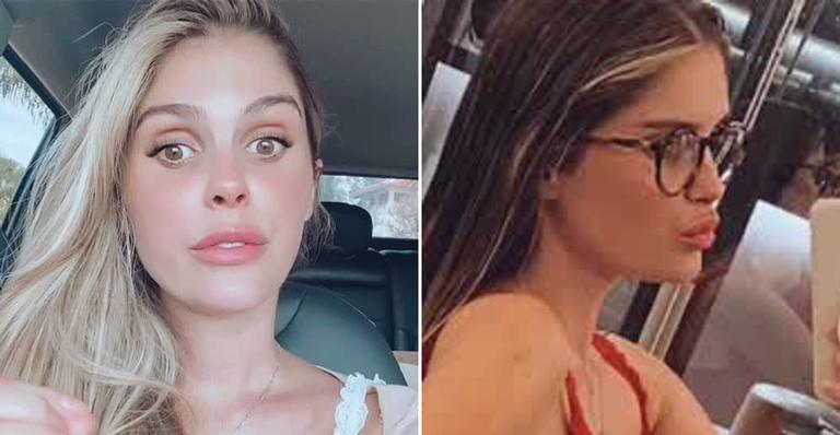 Bárbara Evans mostra resultado de lipoaspiração nos braços seis dias após o procedimento
