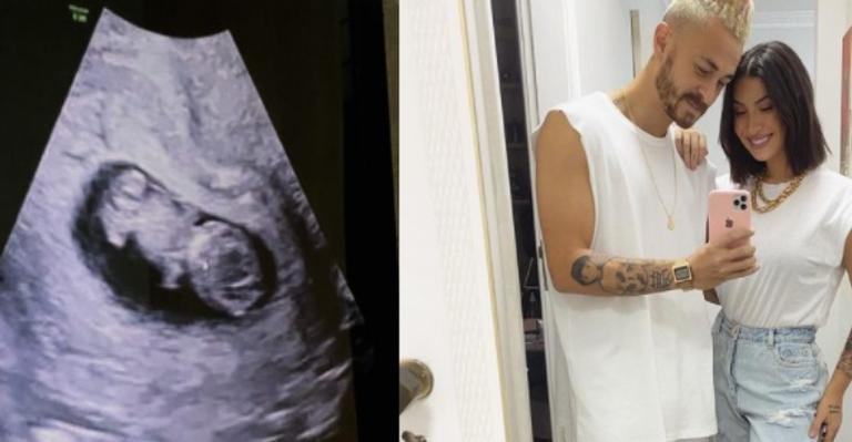 Bianca Andrade mostra ultrassom de sua primeira gravidez: ”Mãozinhas formadinhas”