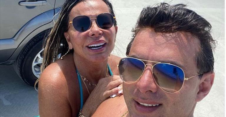 Que mudança! Marido de Gretchen choca a web ao mostrar antes e depois de transformação visual: “Parece outra pessoa”