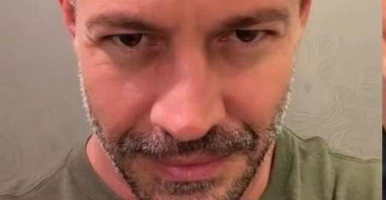 Aos 45 anos, Malvino Salvador faz implante capilar e exibe resultado na web: “Bem natural”