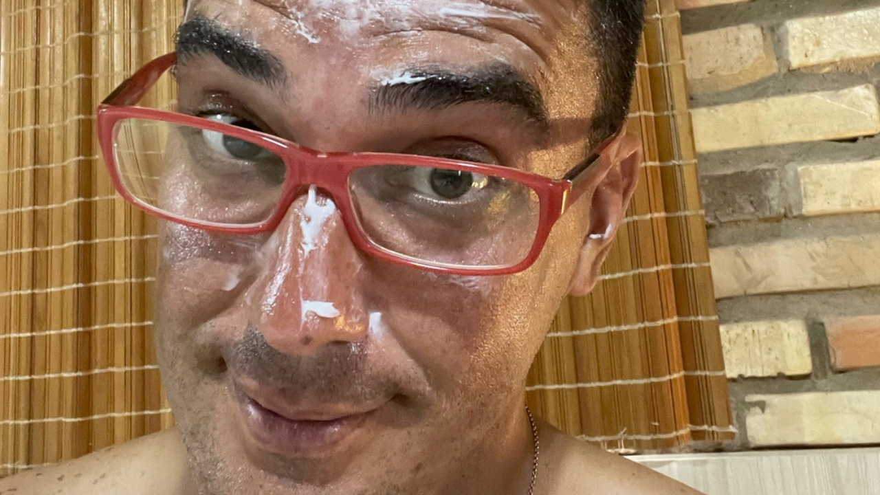 No Limite: André Marques faz desabafo sincero sobre gravações e mostra rosto queimado: “Apresentador também sofre”