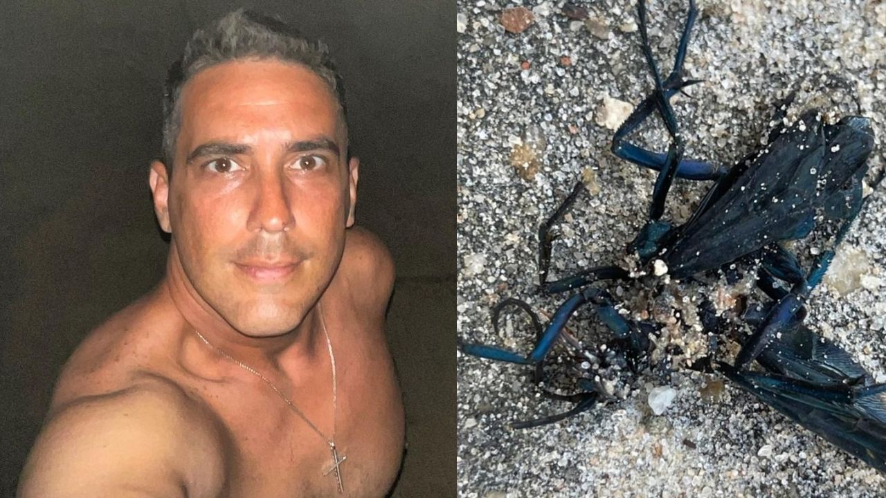 Susto! André Marques sente fortes dores após ser picado por inseto nos bastidores de ‘No Limite’: “Deu ruim”