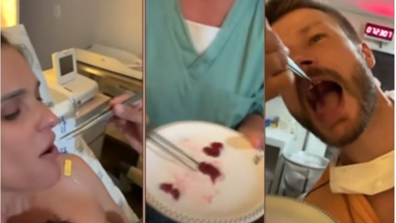 Fernanda Lima e Rodrigo Hilbert mostram momento em que comem a placenta da filha: “Para chocar a sociedade”