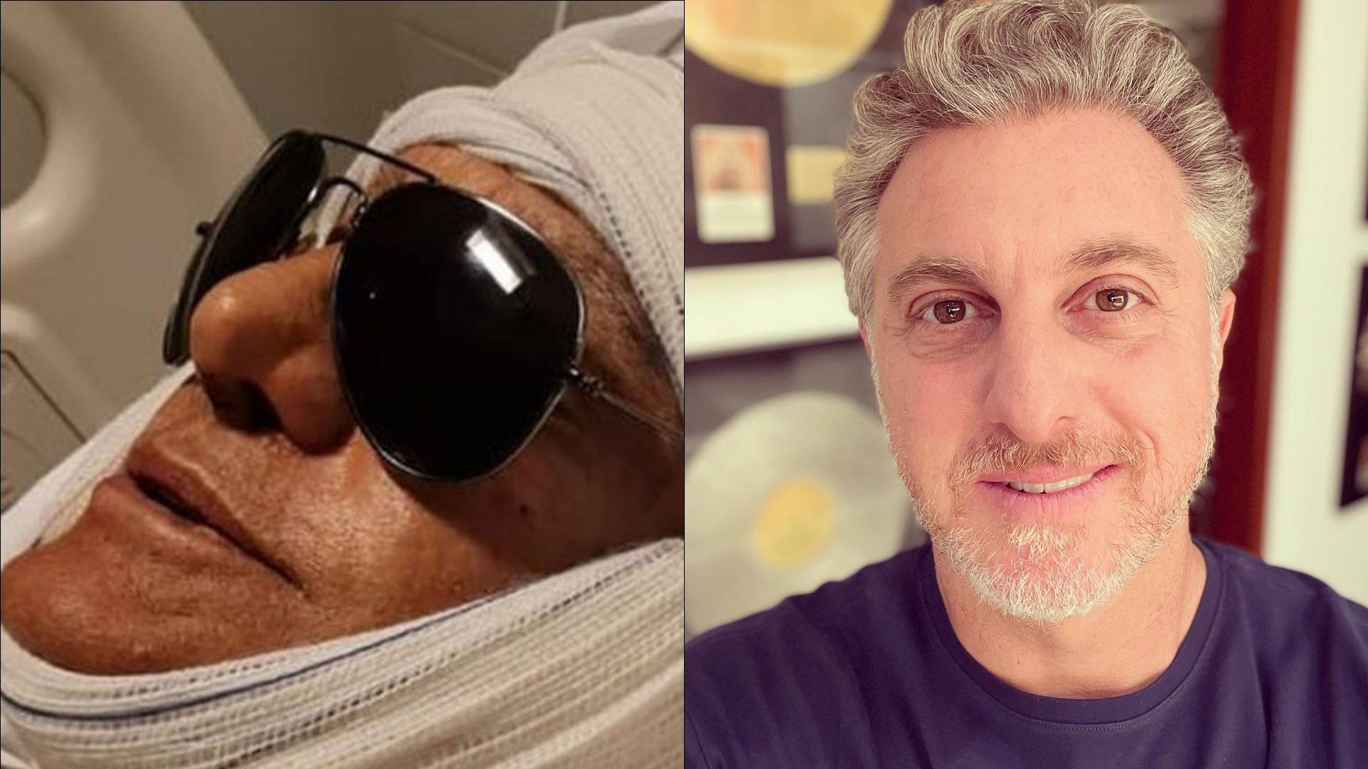 Amin Khader fica insatisfeito com nariz após rinoplastia: “Parece do Luciano Huck”