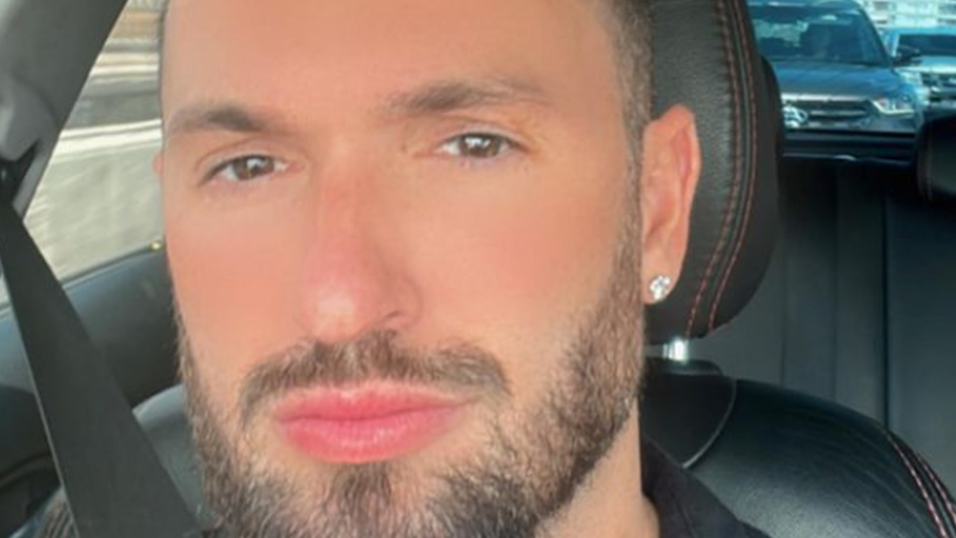 Diego Hypolito choca com antes e depois de procedimentos: “Mudei muito”
