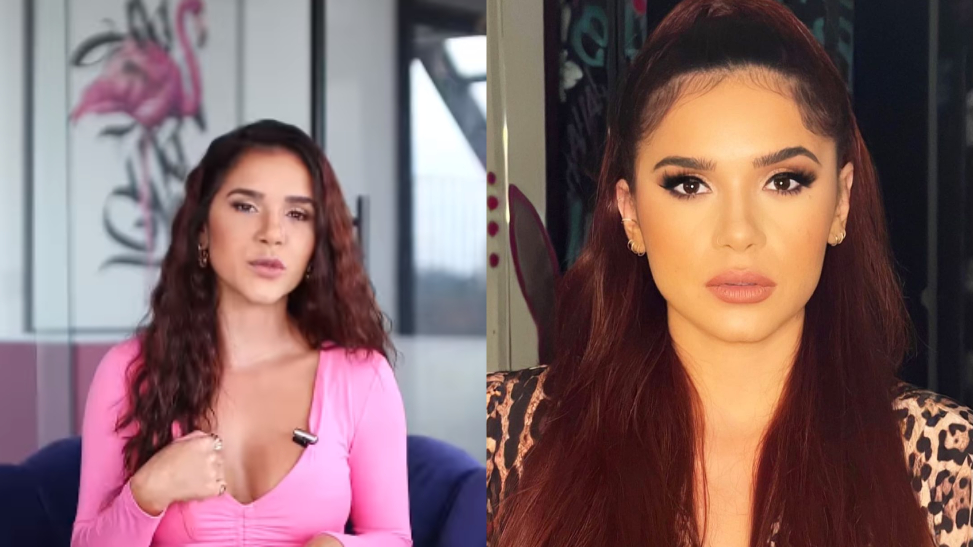 Ex-BBB Gizelly desabafa sobre complicações em cirurgia: “Costurou três vezes”