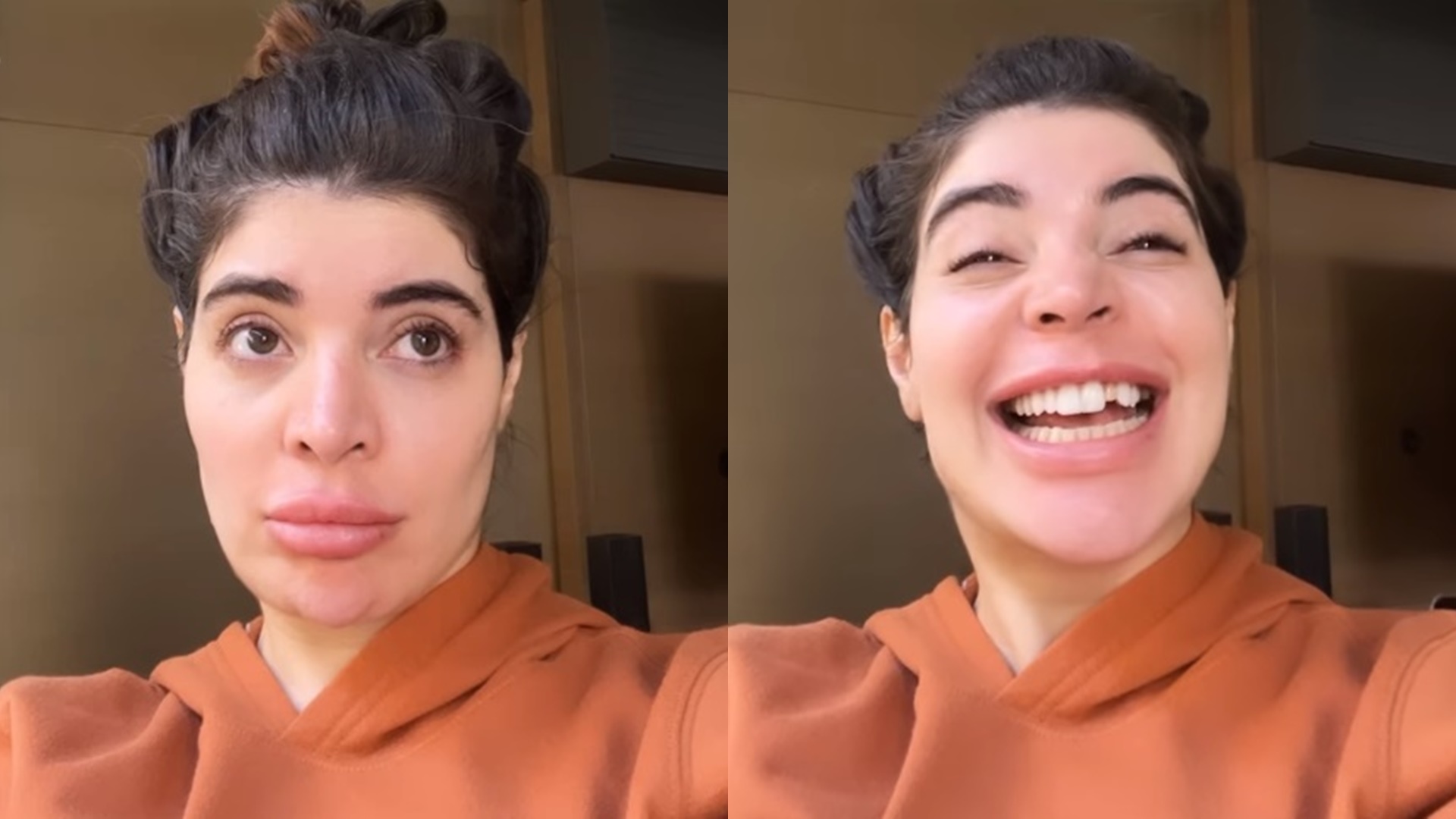 Gkay fica banguela choca fãs ao surgir sem dente nas redes sociais: “Fiz uma merd*”
