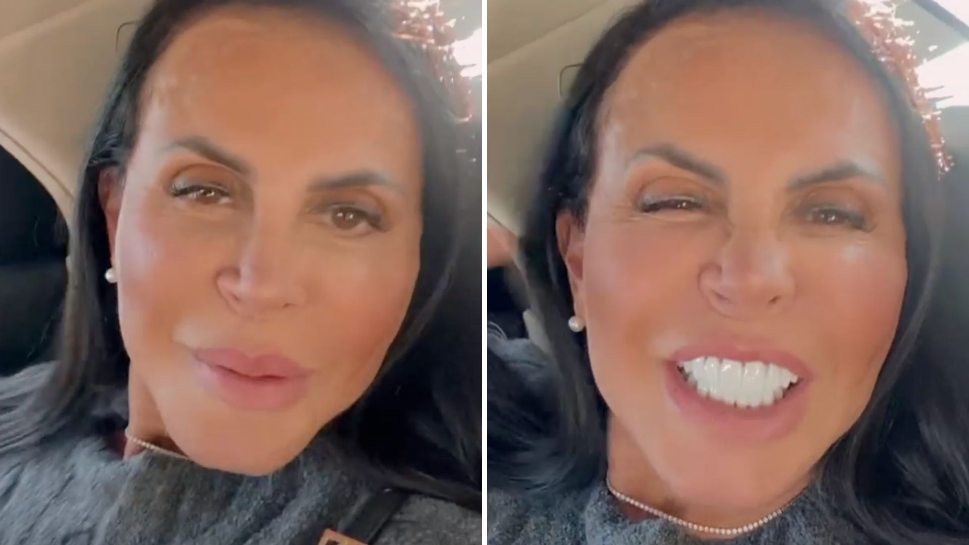 Gretchen comemora resultado de preenchimento vaginal: “Libido sempre dez”