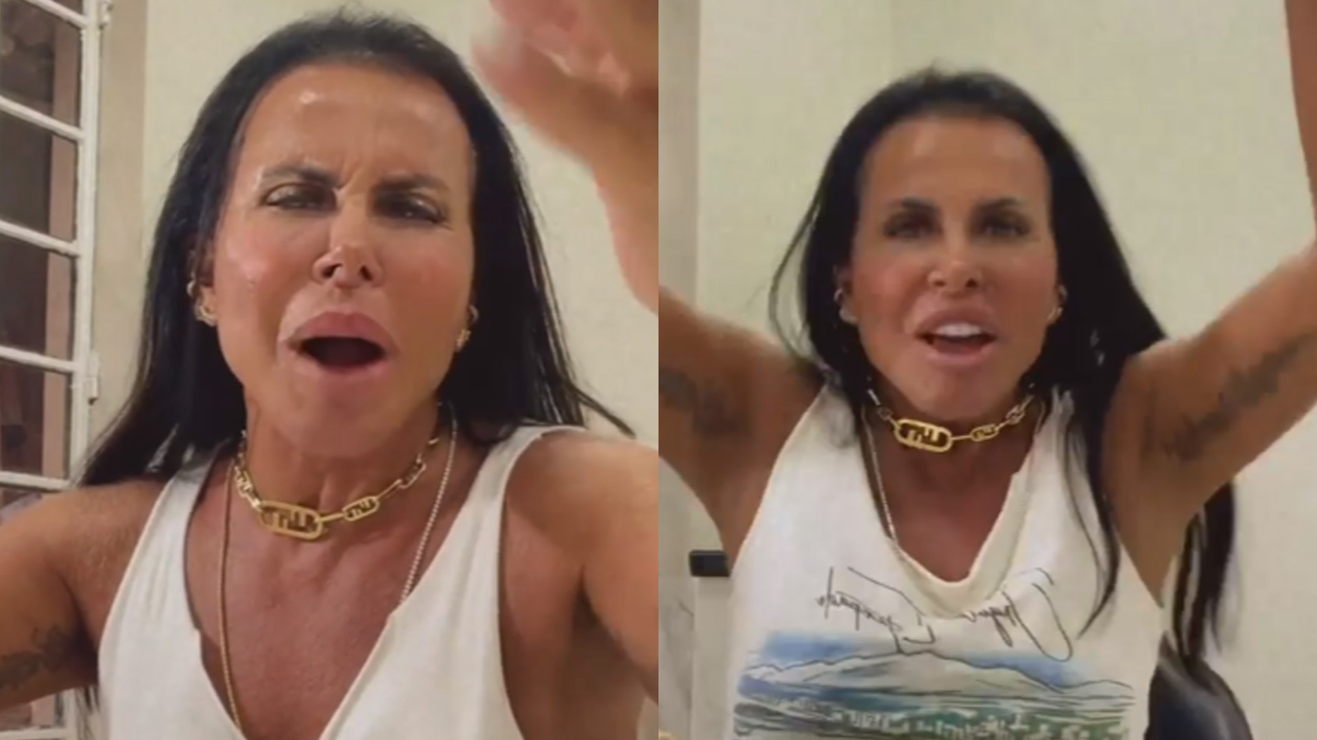Gretchen explica peito peludo e dispara: “Escolhi ter pelo e não ter celulite”