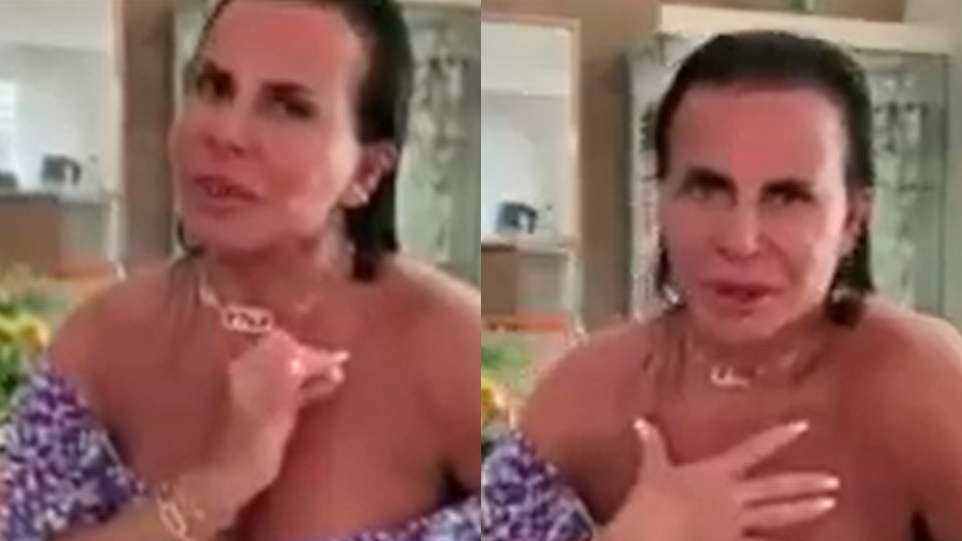 Gretchen alfineta haters após polêmica com pelos e detona: “Fica super sensual”