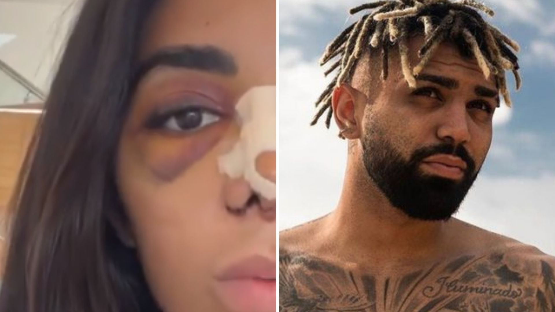 Irmã de Gabigol diz que jogador não consegue olhar para ela após cirurgia: “Agonia”