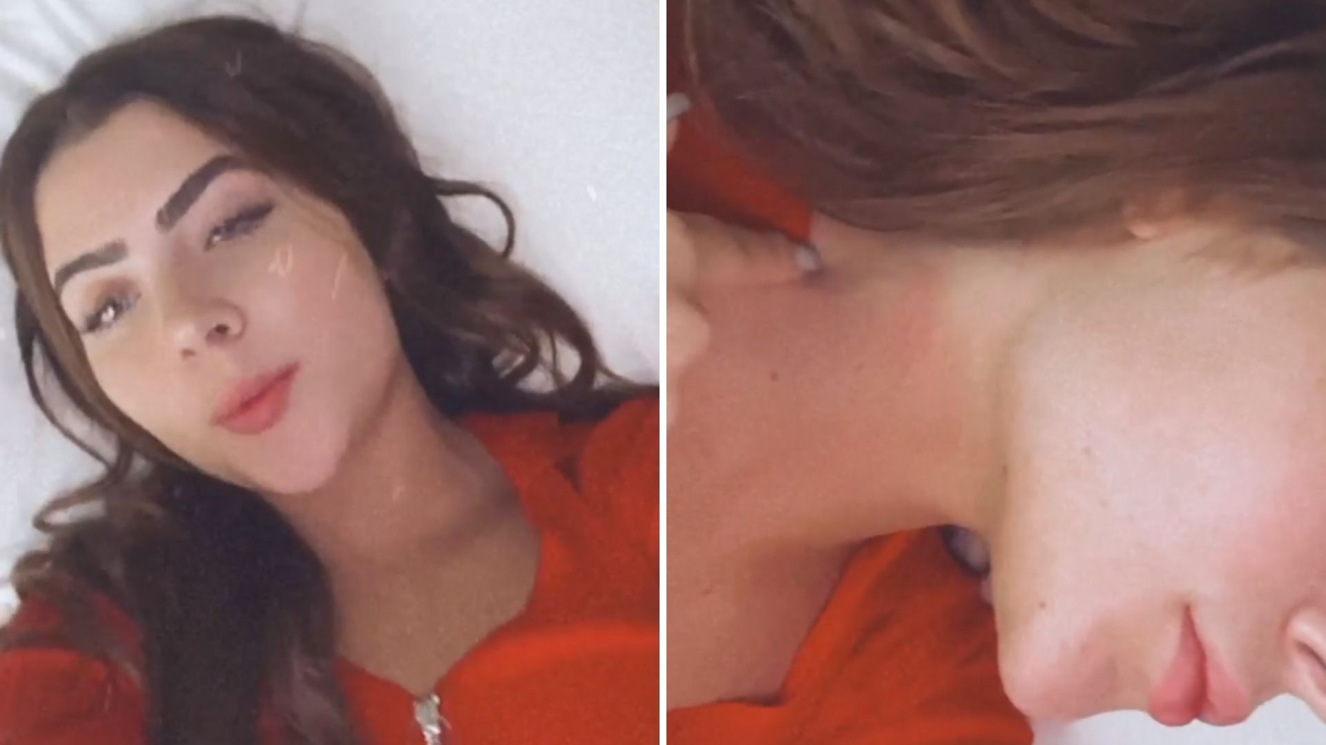 Jade Picon surge com hematoma no pescoço e relata acidente em casa: “Me queimei”