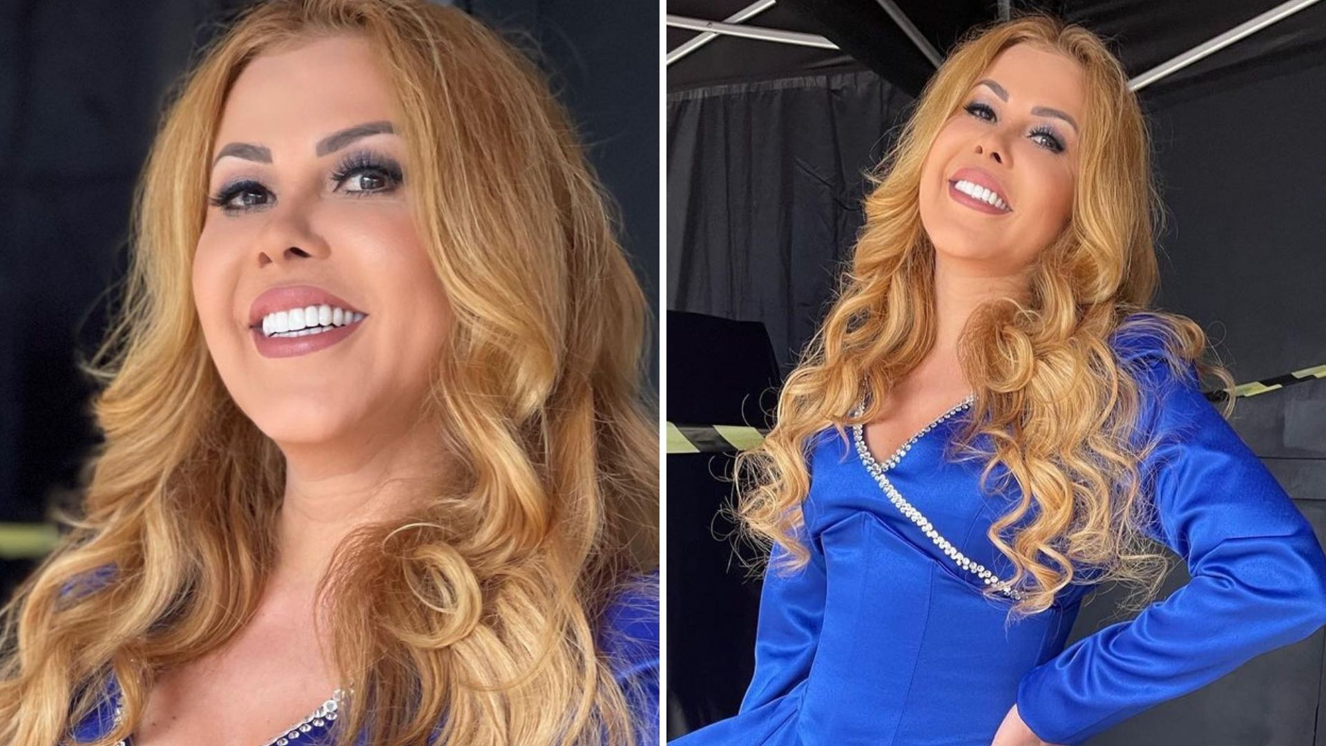 Joelma divide sequência de selfies após surgir com o rosto inchado: “Seja forte”