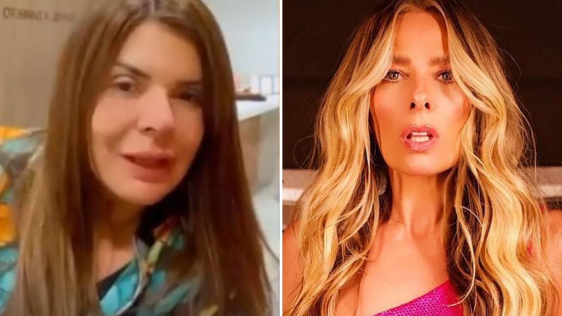 Mara Maravilha alfineta ao ter nariz deformado por procedimento: “Praga da Galisteu”