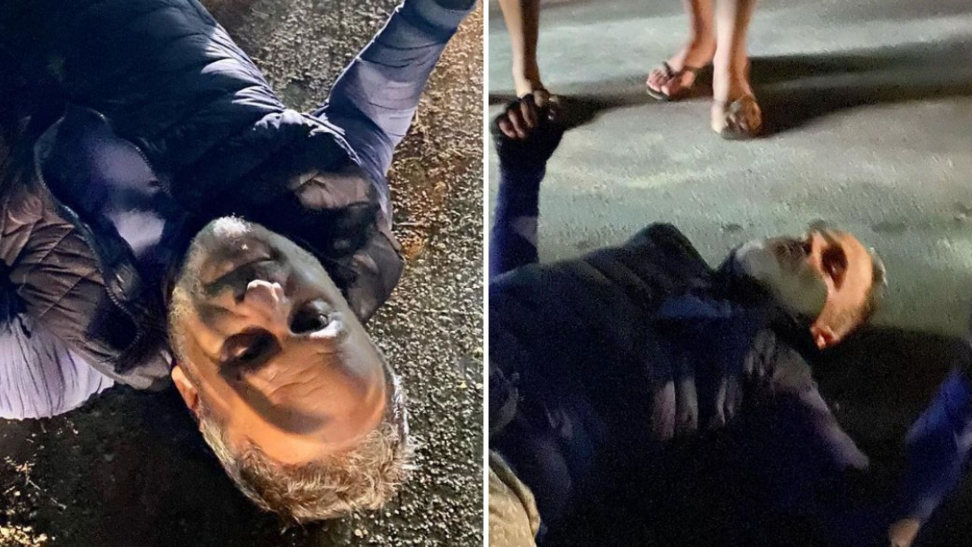 Marcos Breda exibe imagens assustadoras após acidente grave: “Fratura múltipla”