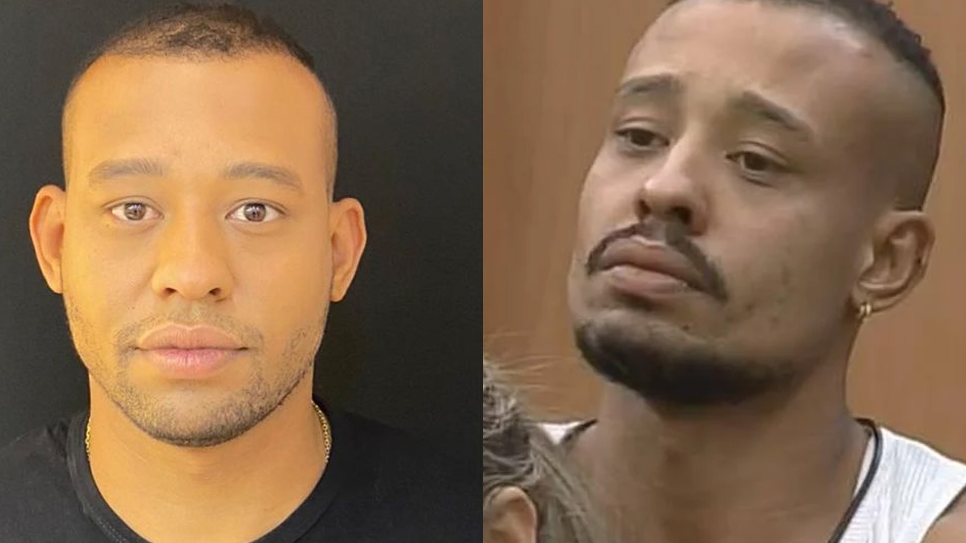 Mussunzinho tem antes e depois de procedimento estético revelado: “Detalhes”
