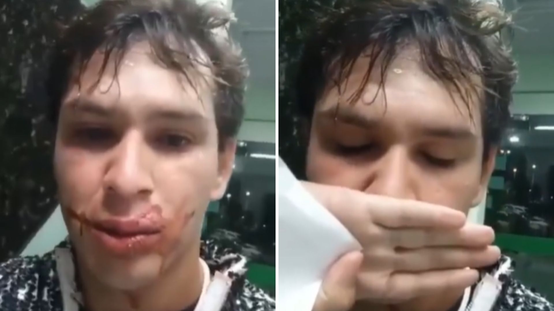 Repórter do SBT é roubado e agredido após show de Joelma: “Foi muito rápido”