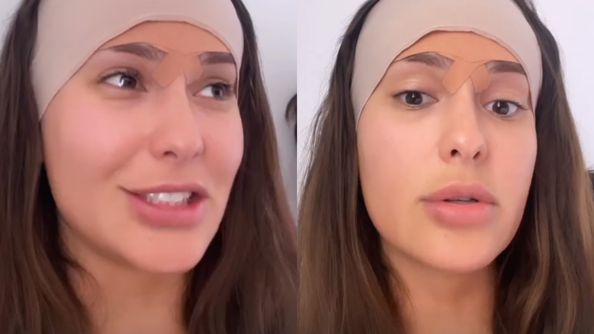 Ex-BBB Thaís Braz passa por cirurgia para diminuir a testa: “Dois centímetros”