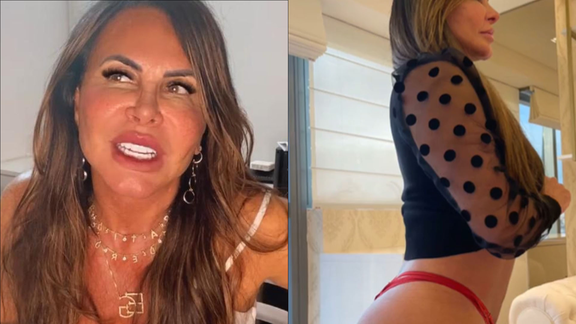 Gretchen se revolta com críticas após procedimento estético no bumbum: “Recalque”